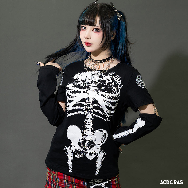 レントゲンロンT – ACDC RAG